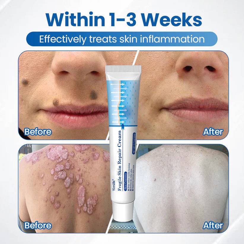 Timilk Fragile Skin Repair