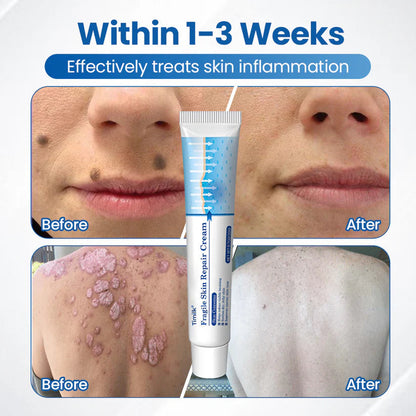 Timilk Fragile Skin Repair