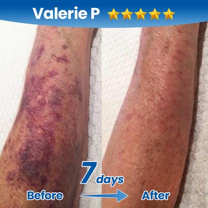Timilk Fragile Skin Repair