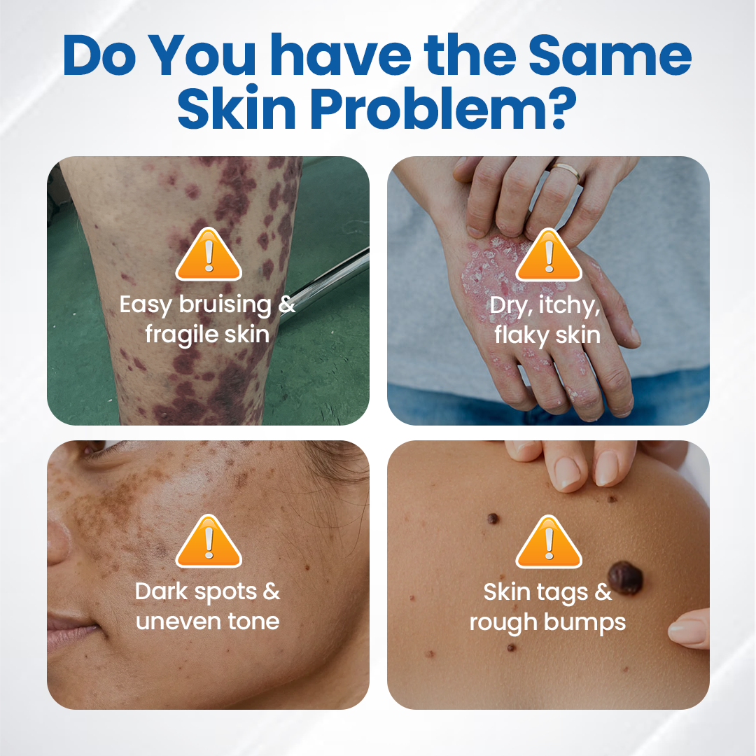Timilk Fragile Skin Repair