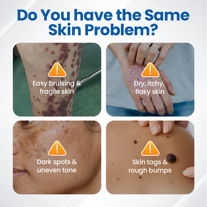 Timilk Fragile Skin Repair