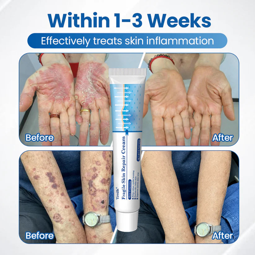 Timilk Fragile Skin Repair