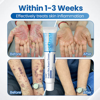 Timilk Fragile Skin Repair