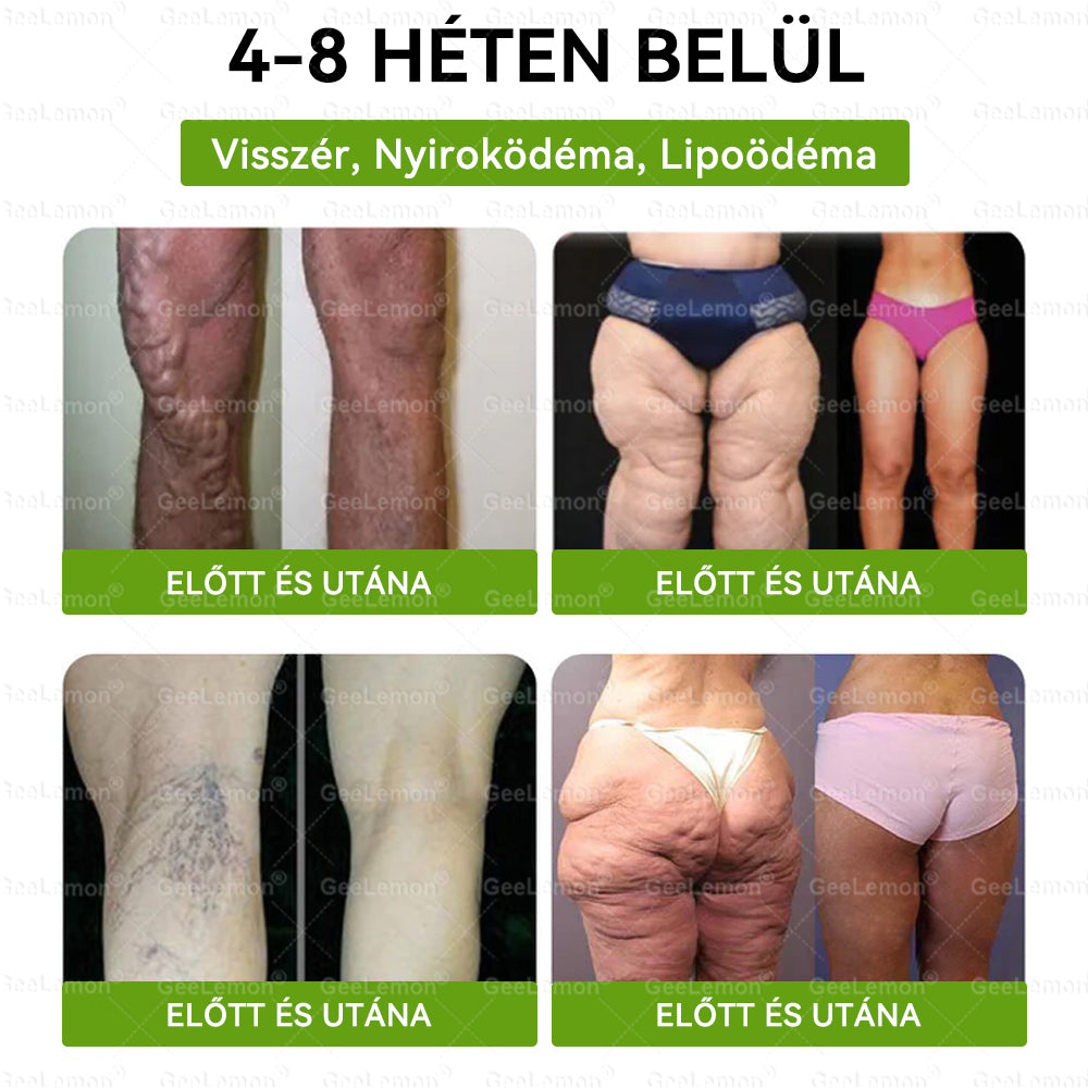 Ajánlott a Semmelweis Kórház által · 👩‍⚕️BENU hivatalos üzlet| 🎁 𝐆𝐞𝑒𝐿𝑒𝐦𝐨𝐧® Glumasetide 8 az 1-ben Karcsú és Egészséges Nano Mikrotűs Tapasz-hutplj06🇭🇺