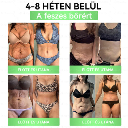 🎄🎄Ajánlott a Semmelweis Kórház által · 👩‍⚕️BENU hivatalos üzlet| 🎁 𝐆𝐞𝑒𝐿𝑒𝐦𝐨𝐧® Glumasetide 8 az 1-ben Karcsú és Egészséges Nano Mikrotűs Tapasz🍀🍀🍀🍀